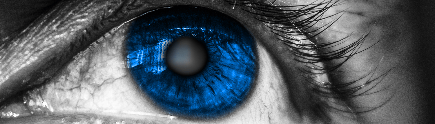 Illustration of a cloudy blue eye with cataracts