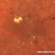 Image of Diabetic Retinopathy