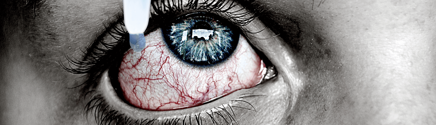 Red Irritated Eye illustration