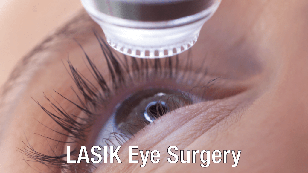 LASIK Eye Surgery Serving Plano Dallas Fort Worth LASIK
