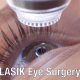 illustration of LASIK technology