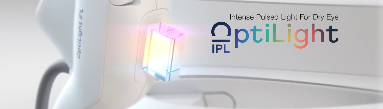 Intense Pulsed Light (OptiLight IPL) for Dry Eye