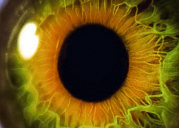 Image of a clear eye after Yag following Cataract surgery