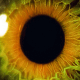 Image of a clear eye after Yag following Cataract surgery